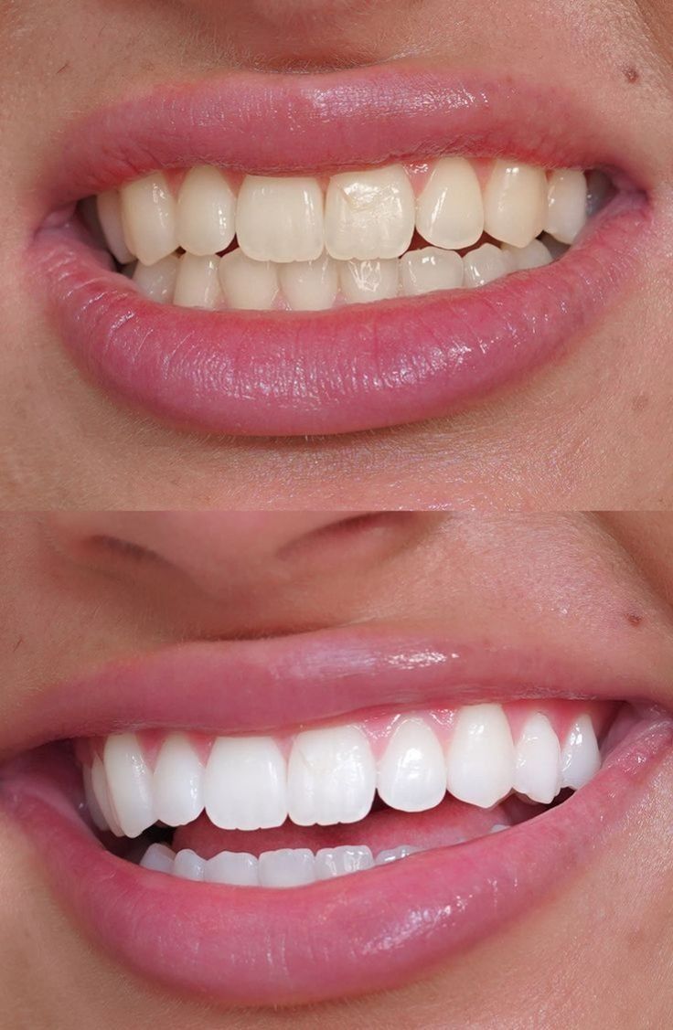 Transform Your Smile, Transform Your Confidence